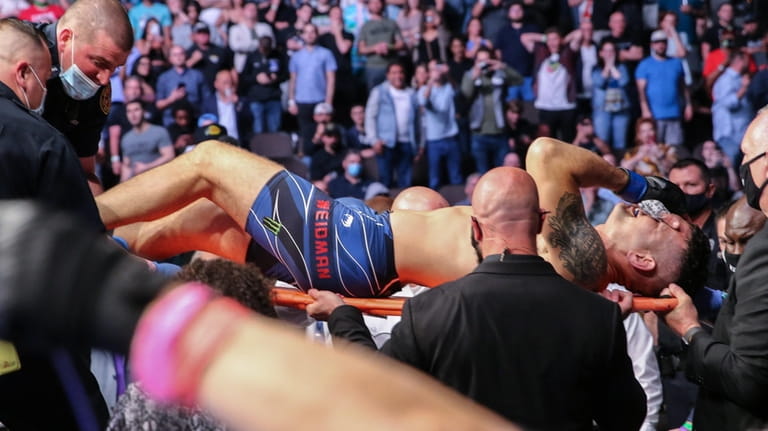 Chris Weidman of leaves the fight on a stretcher after breaking...