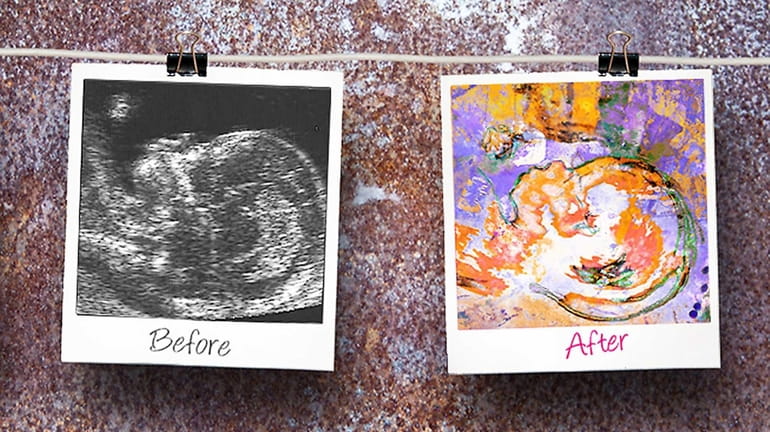 Have your baby-to-be's 2D/3D sonograms made into colorful works of...