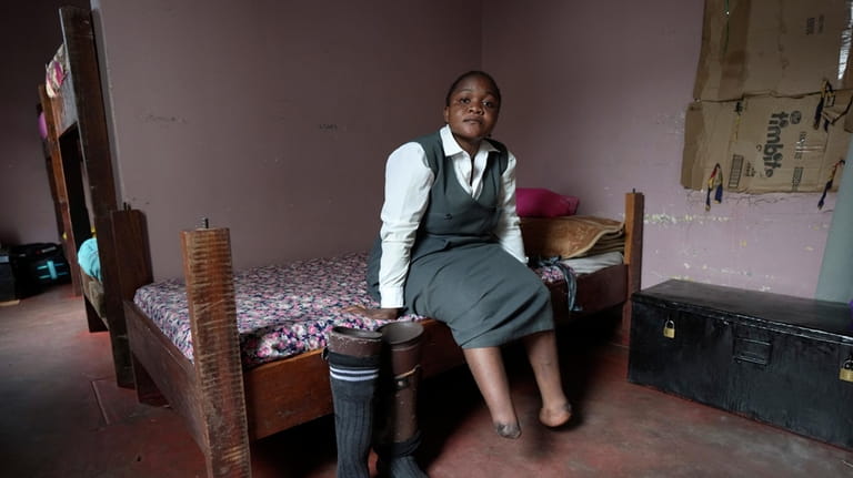 Bridget Chanda sits on her bed next to her prosthetic...