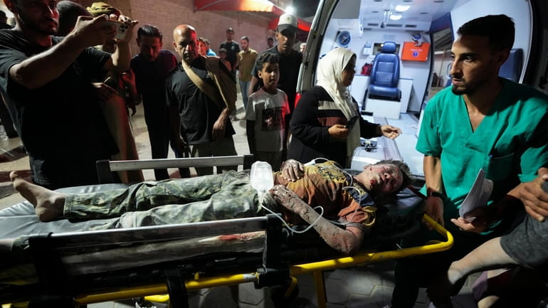 A Palestinian wounded in an Israeli bombardment on the Gaza...