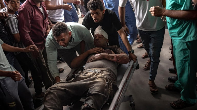 A Palestinian wounded in Israeli bombardment of the Gaza Strip...