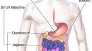 Small study suggests people with condition absorb glucose more rapidly