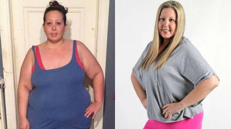 Woman is unrecognisable after losing 13st and £20,000 of surgery