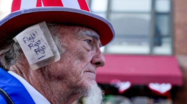 A supporter, donning an ear bandage in solidarity' with former...