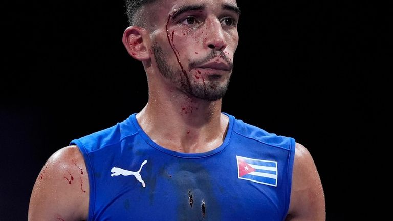 Blood runs down Cuba's Saidel Horta's face after fighting Kyrgyzstan's...