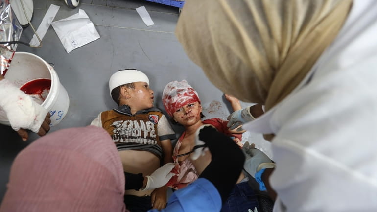 Palestinian children wounded in the Israeli bombardment of the Gaza...