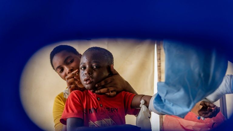 A health worker attends to a mpox patient, at a...