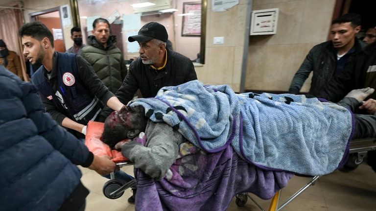 Palestinians wounded in the Israeli bombardment of the Gaza Strip...