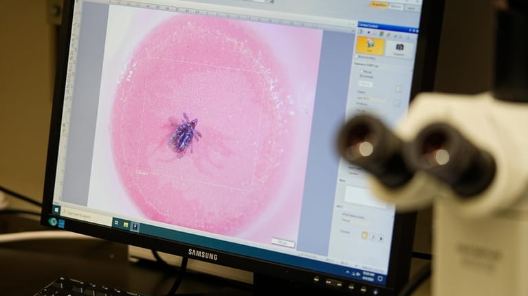 A tick is viewed atop a pencil eraser in the...