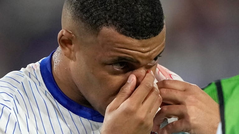 Kylian Mbappe of France holds his nose after suffering an...