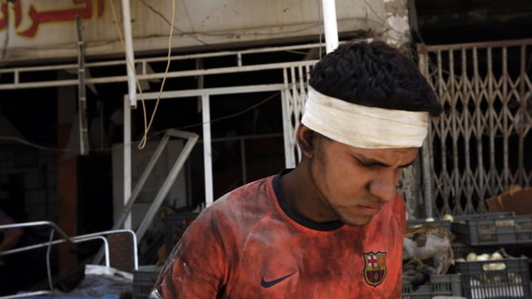 An injured man is seen after twin car bombs exploded...