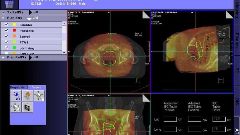 A clinical prostate image