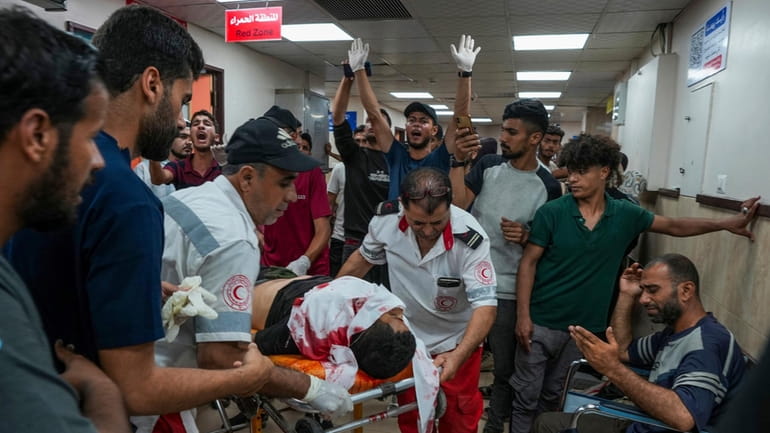 Palestinians wounded in the Israeli bombardment of the Gaza Strip...
