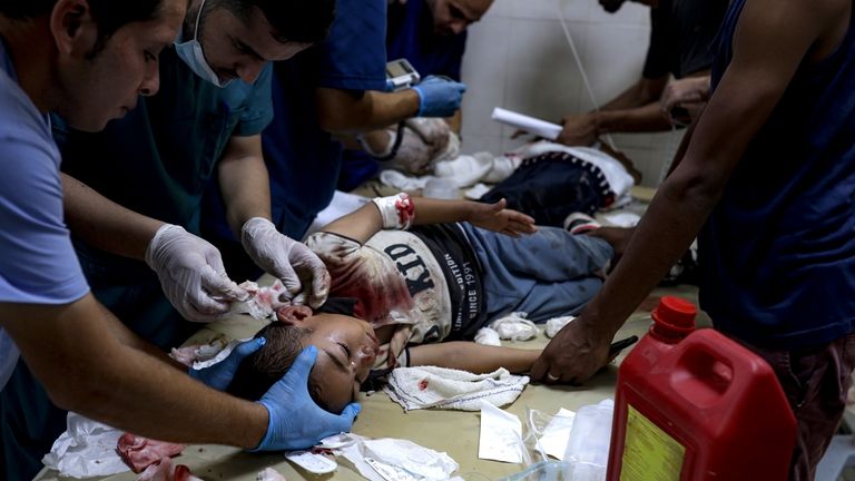 A Palestinian boy wounded in the Israeli bombardment of the...