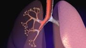 Findings may help determine if person has the lung disease...