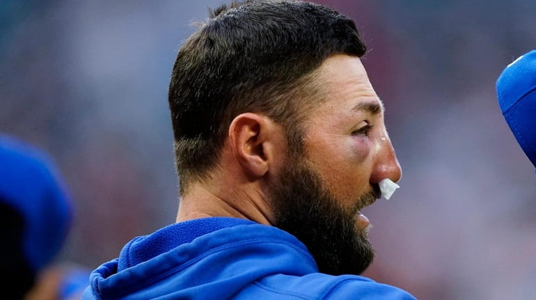 Tim Healey on X: Kevin Pillar's nose remains broken — it takes 4-6 weeks  for the bone to heal, he said — and he plans to wear a mask in the outfield