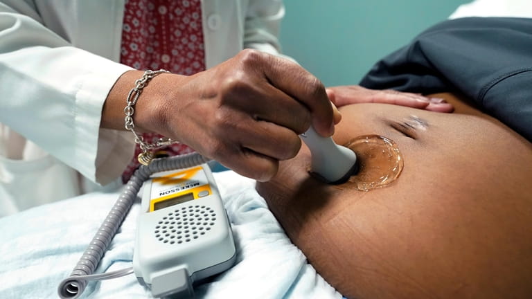 A doctor uses a hand-held Doppler probe on a pregnant...