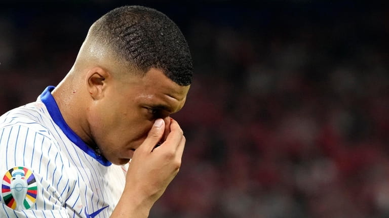 Kylian Mbappe of France holds his nose after suffering an...