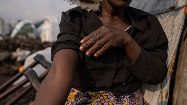 Sarah Bagheni, in the Bulengo refugee camp in Goma, Congo,...