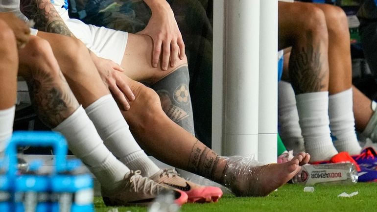 Argentina's Lionel Messi sits on the bench with an ice...