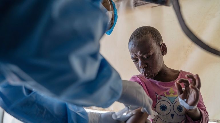 A health worker attends to a mpox patient, at a...