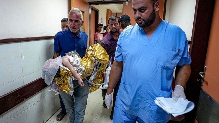 Palestinian Child Siwar Abdel-Hadi, 2, wounded in the Israeli bombardment...