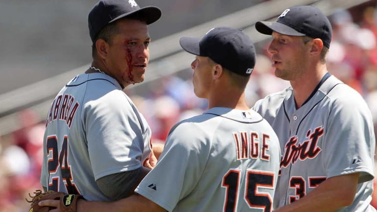 Detroit Tigers' Miguel Cabrera, left, is checked by teammates Brandon...