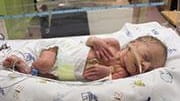 Low birth weight also more likely, researchers found