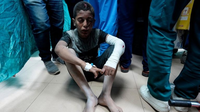 A Palestinian child wounded in the Israeli bombardment of the...