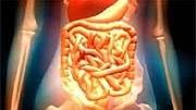 There's been research to suggest that changes in 'good' intestinal...