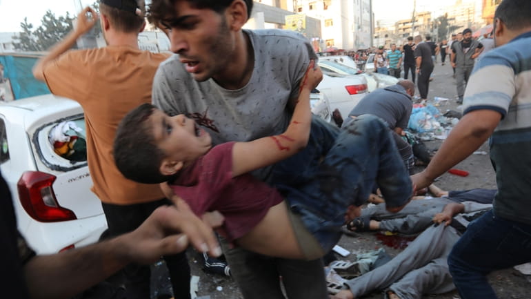 An injured Palestinian boy is carried from the ground following...