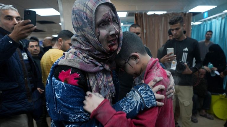 Palestinians wounded in the Israeli bombardment of the Gaza Strip...